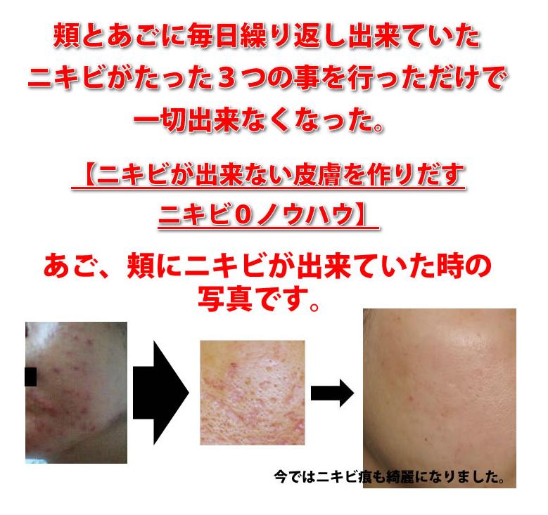 �y���ʃZ�b�g�z�j�L�r���o���Ȃ��畆�����o���j�L�r0�m�E�n�E